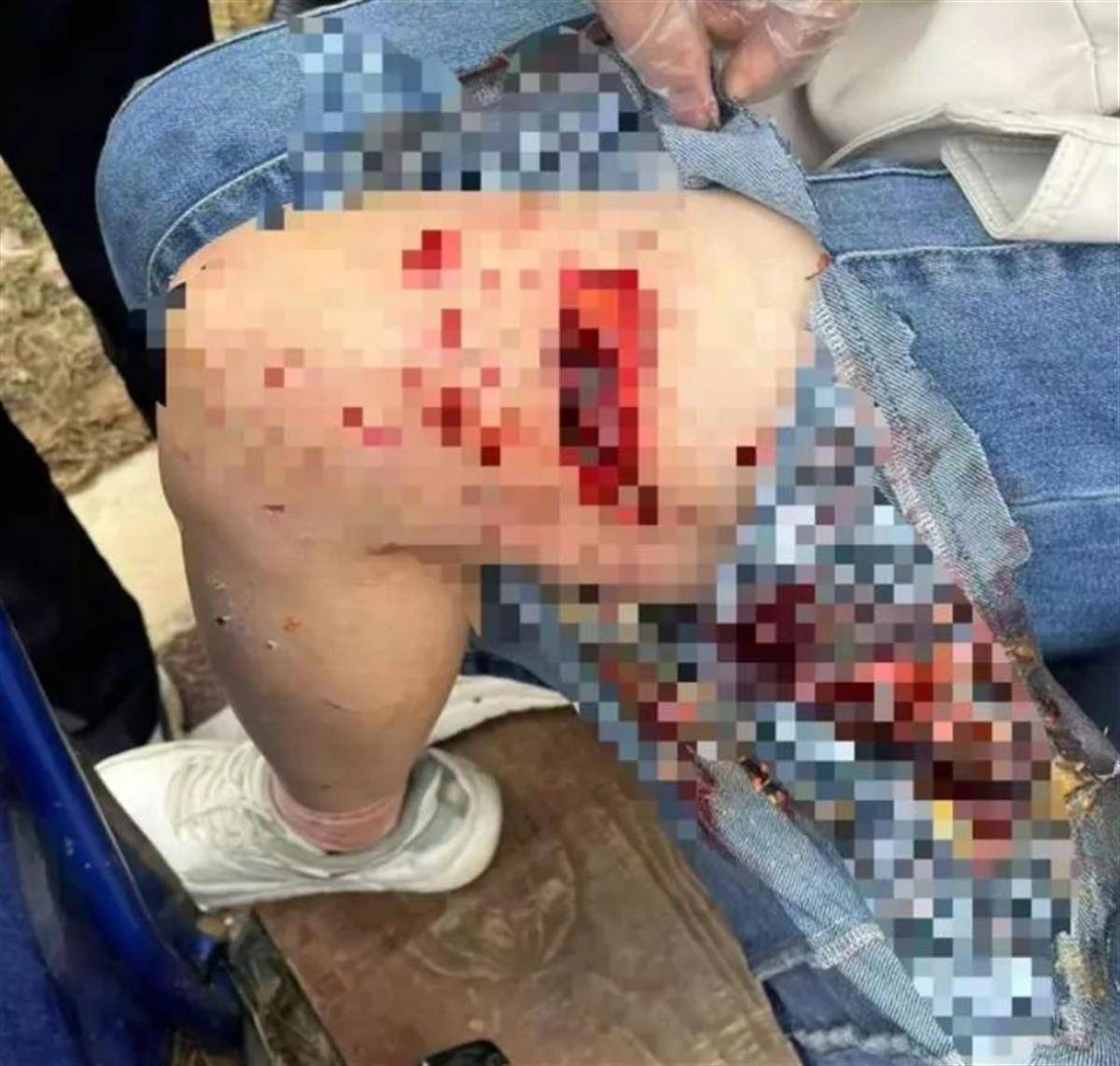 撕咬母女的四条大型犬系杂交品种,律师:犬主若过失致人轻伤,不构成犯罪