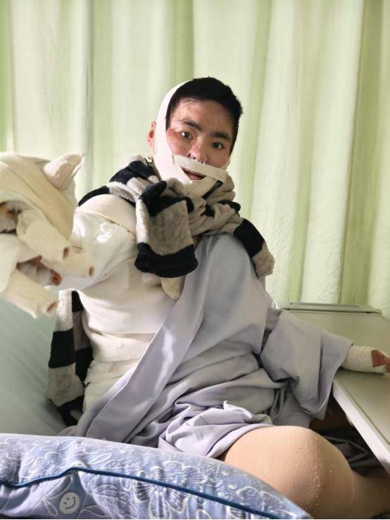 女孩被前男友泼汽油致残,凶手法庭上威胁杀人