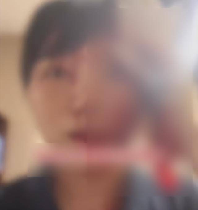 缝了20多针！女子称被不知名男同事砸头毁容，警方介入