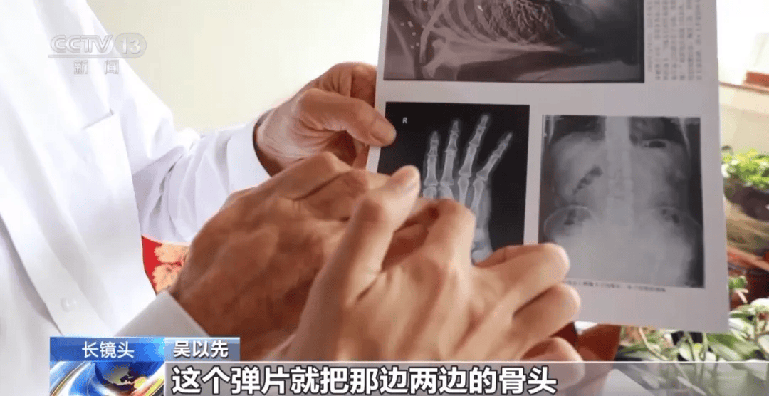 “老先生,您把项链取下来再做CT”