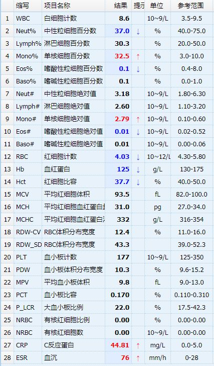 常规xrp(常规xrd一般能测啥)
